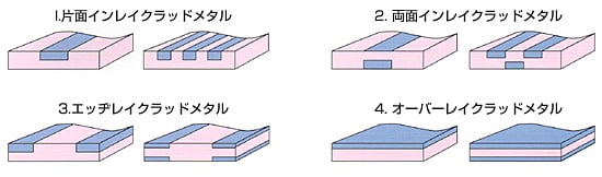 Ⅱクラッドの種類・形状